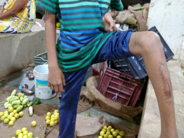 Help Prajwal Walk And Run