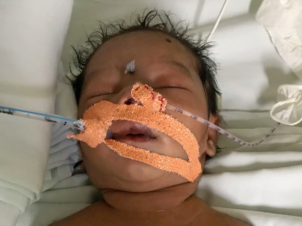 Help Newborn Baby Girl In Her Fight For Survival.