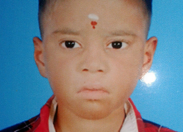 Need money to baby operation
