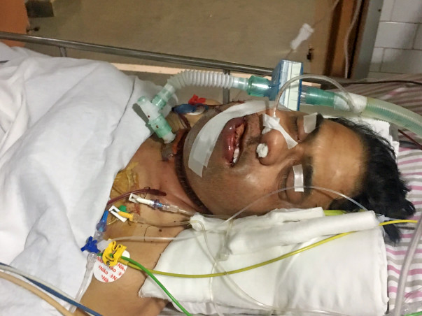 Help Sanjeev Kapoor suffering from Oral Cancer