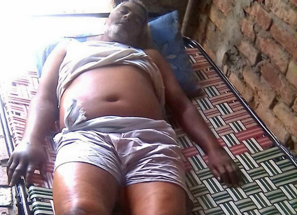Poor Man On Verge Of Death Due To A Stomach Tumor Needs Your Help