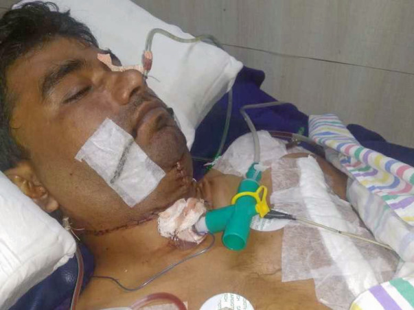 Help My Husband To Fight With Tongue Cancer
