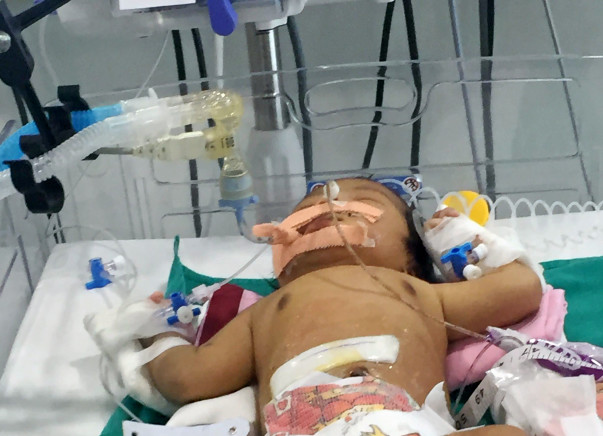 Help My Child to fight very rare disease Short Bowel Syndrome