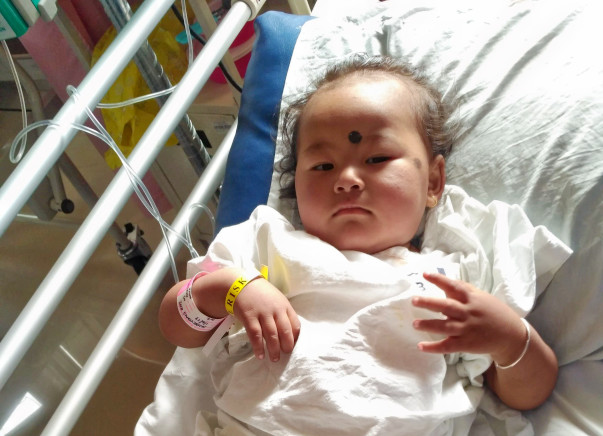Liver transplant needed to save a child