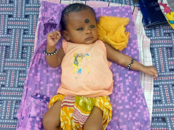 1 Month Old Baby Of Bhagyalakshmi Needs Your Help Fight Congenital Umbilical Hernia