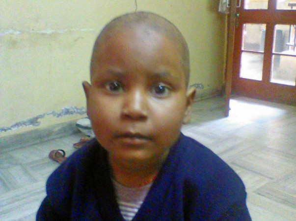 5 Years Old Gunjan Needs Your Help To Fight Blood Cancer