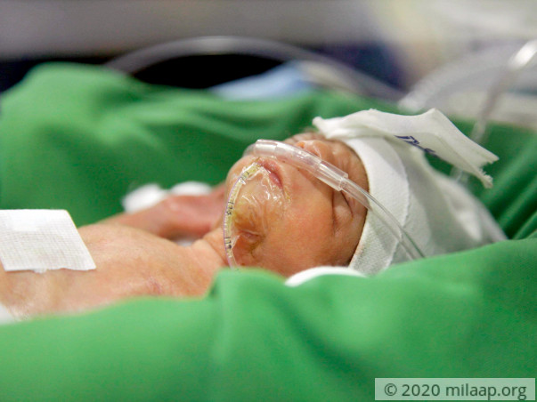 Only 6 Days Old, This Baby Is Not Strong Enough To Breathe On His Own