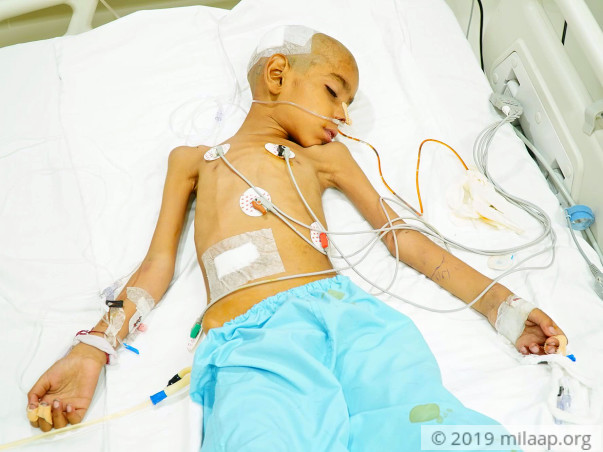 Shivam Singh needs your help to undergo his treatment