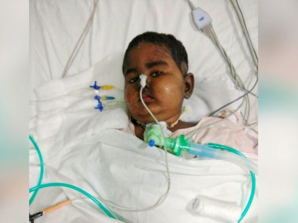 SAVE BABY KAYALVIZHI FROM CANCER !
