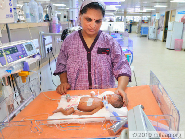 This Newborn Cannot Survive Without 6 Weeks Of Life Support