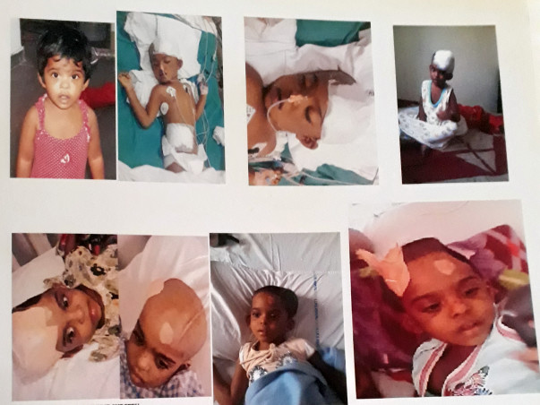 Help Hepsiba Fight A Serious Head Injury