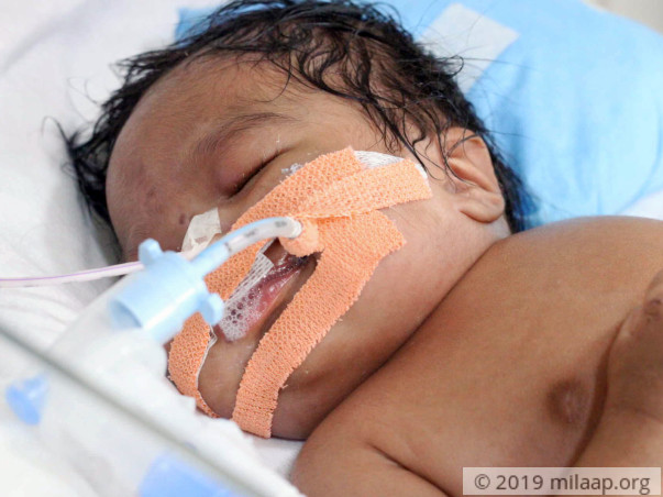 Poor Couple Is In Desperate Need Of Help To Save Their Baby Girl