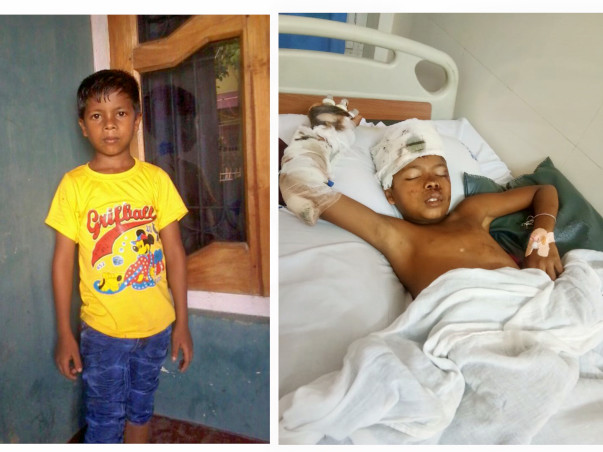 Run Over By A Truck, 9-Year-Old Boy Has No Family To Help Him