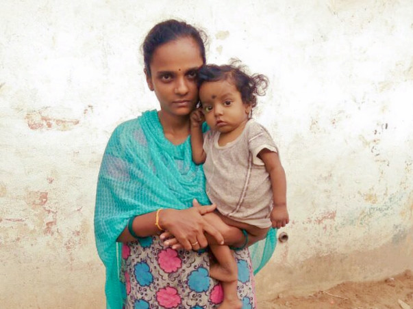Please Help 1 Year Old Devansh Fight Biliary Atresia