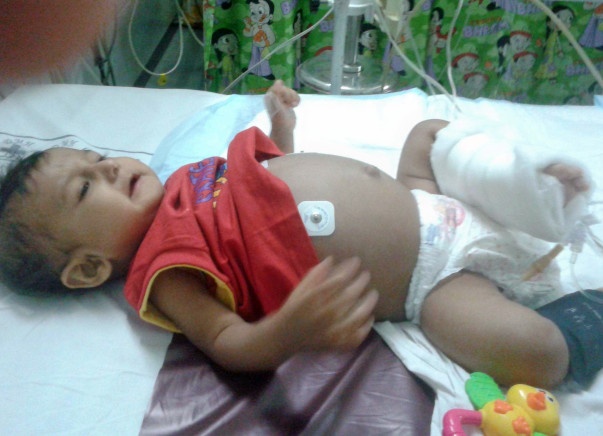 Save Burhanuddin, Liver transplant required
