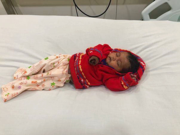 Help 3-month-old Gunjan fight a severe heart disease