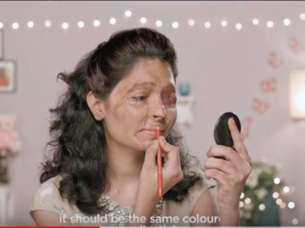 Rehabilitation Center For Acid Attack Victims