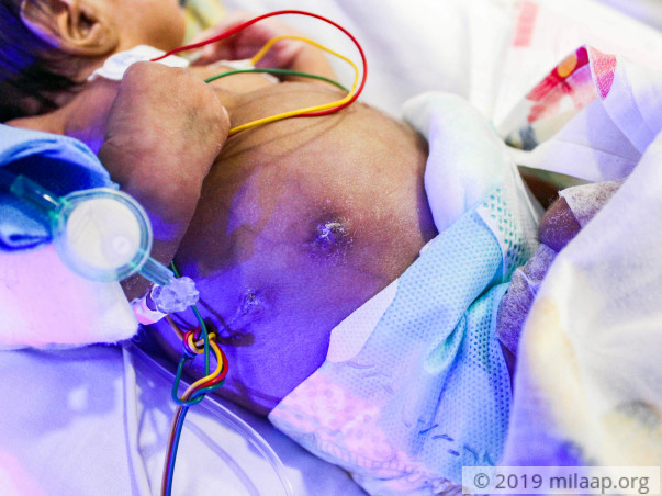 Baby of Lucky needs your help to fight disease