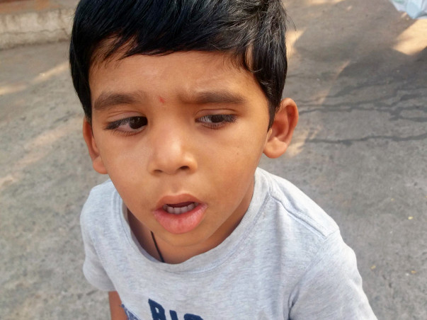 Help 4-year-old Yuvan who met with a tragic accident