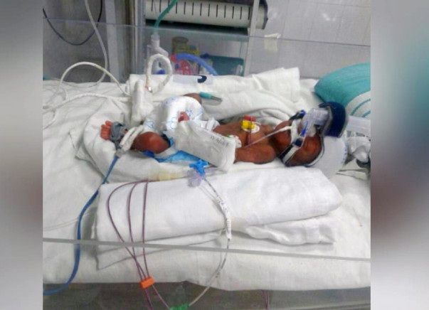 Help This Father Save His 20-Week-Old Daughter