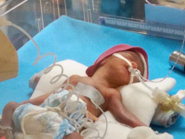 Help This Couple Save Their Extremely Premature Baby