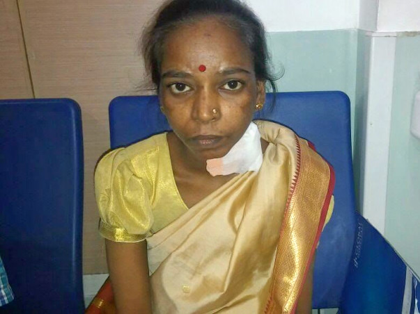 Help Sucheta Undergo A Kidney Transplant