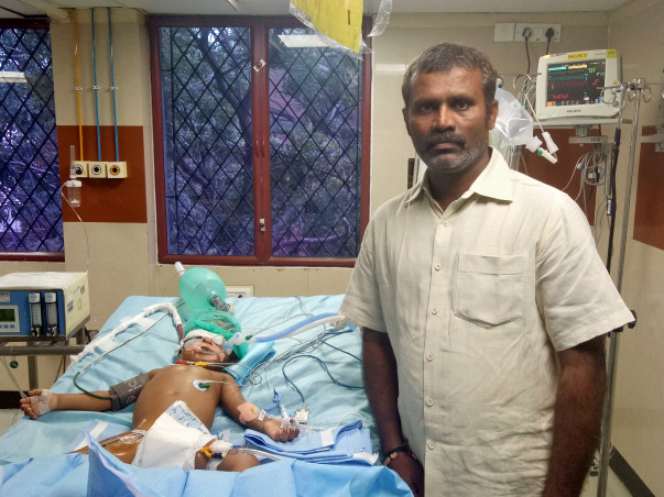 3-year-old Who Drank Paint Thinner Is Suffering From Organ Failure