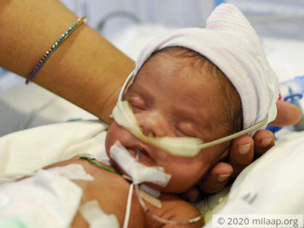 15 days old baby of Shilpi needs your help to survive