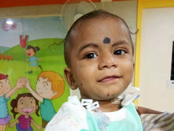 Help baby Likitesh undergo a liver transplant