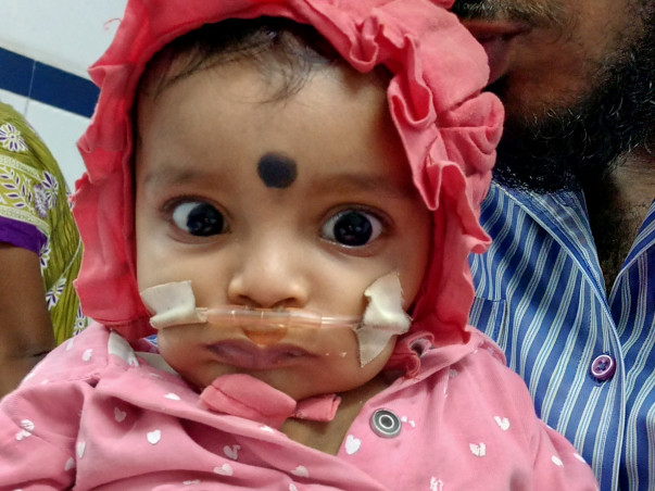 Help 7 Month Baby Aadhvi Undergo A Critical Heart Surgery