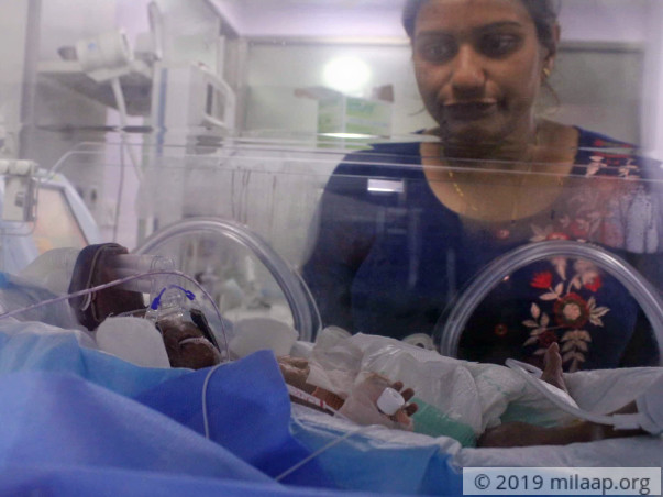 Baby of Sandhyarani needs your help to survive
