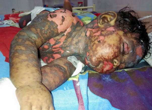 I am fundraising to help to save this 7 months old baby