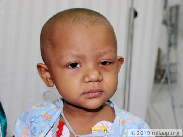 Teacher's 2-Year-Old Will Lose Her Eyesight To Cancer Without Help