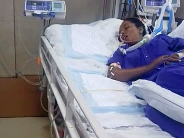 Please Help Nagini Who Is Suffered From Myasthenia Gravis- Urgent.