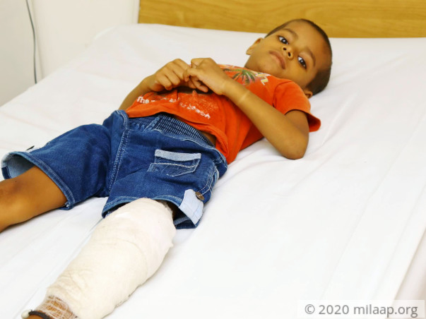 Help Vicky Kumar Recover From Ewing's Sarcoma