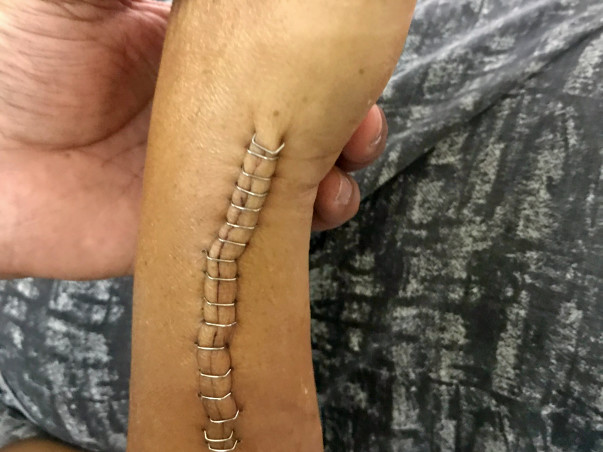 20 years of my nephew is in critical condition due to accident
