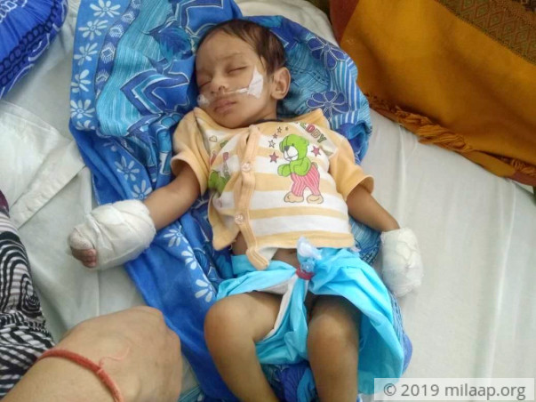 This 2-month-old baby needs an urgent heart surgery to survive
