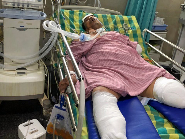 Support Someshekhar B K Recover From Accident