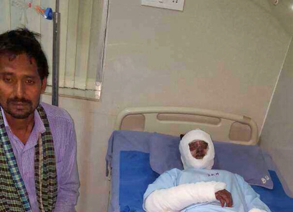 Help Poor Burn Victims from Jharkhand