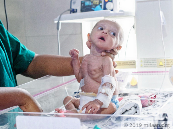 Abu Talha needs your help to undergo his treatment
