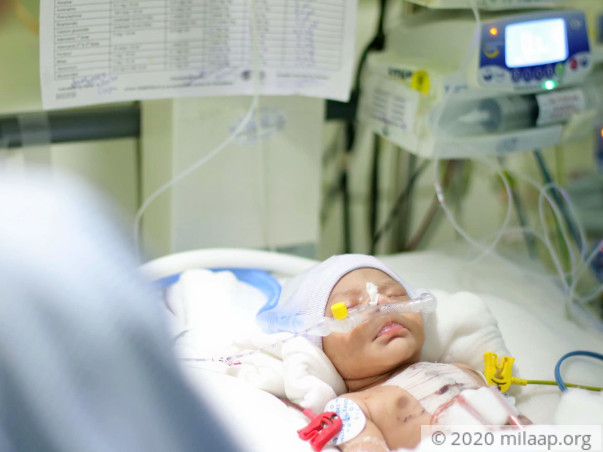 Help Baby of Gayatri Recover