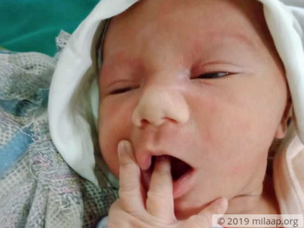 Help My 2 Week Old Son Survive