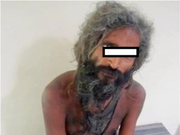 I am fundraising to rehabilitation of Mentally ill destitute