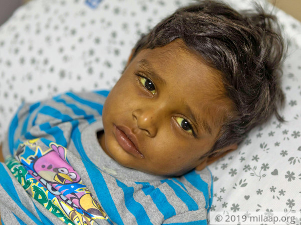 4-year-old Vamshi is fighting a severe liver disease and needs help
