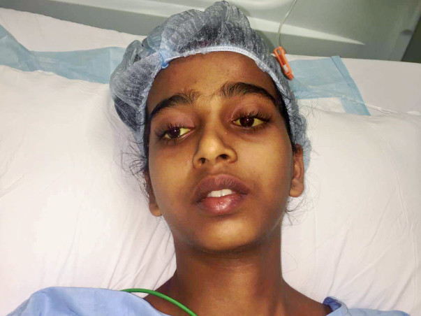 Family Seeks Support For Their 15-Year-Old Daughter's Liver Transplant