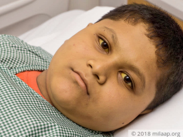 Help Gauranga get a life-saving liver transplant
