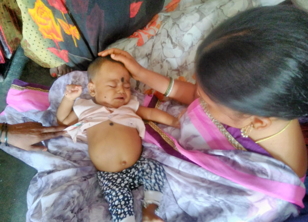 Help Required for Urgent Liver Transplantation For 6 months Old Baby