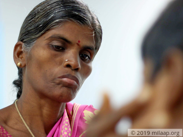 Help Bhavi Shree Fight Acute Promyelocytic Leukemia