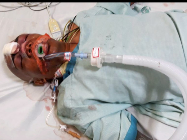 Help Dorababu Fight Battles In The Hospital And Come Out Of Danger