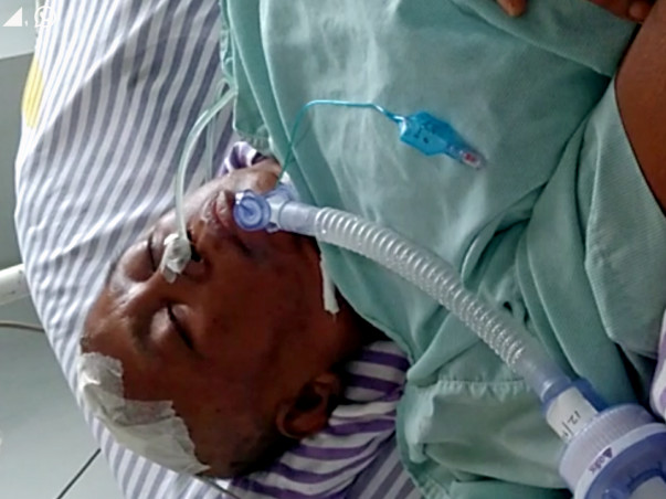 Help to Survive Aneurysm
